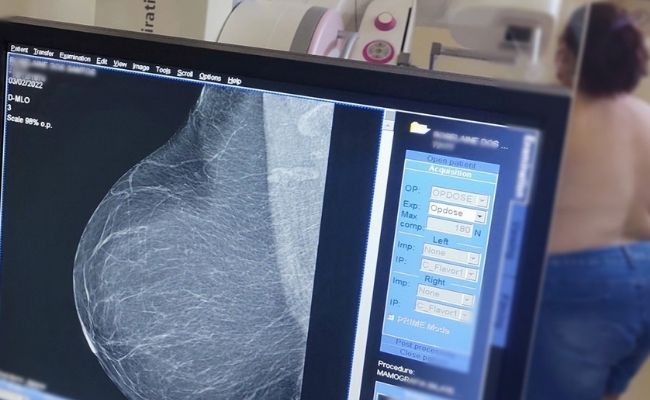 Mamografias serão agendadas diretamente nas unidades de saúde de Novo Hamburgo 